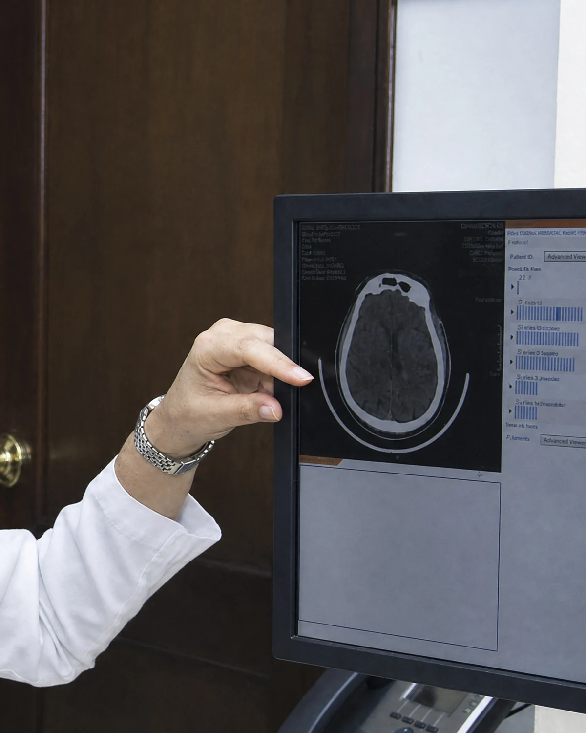 Neuro-oftalmología y nervio óptico en Centro Láser, Santo Domingo